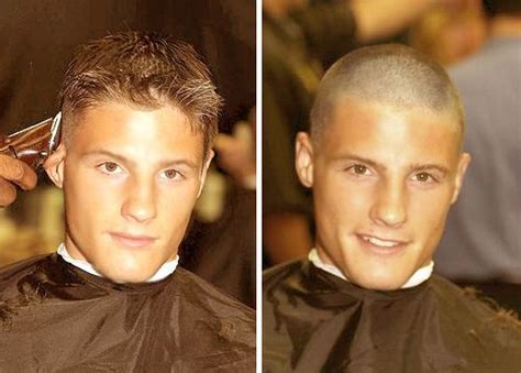 Balding Buzz Cut Before And After