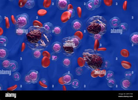 Chronic lymphocytic leukemia (CLL) cells in blood flow - isometric view ...