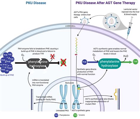 Phenylketonuria Treatment