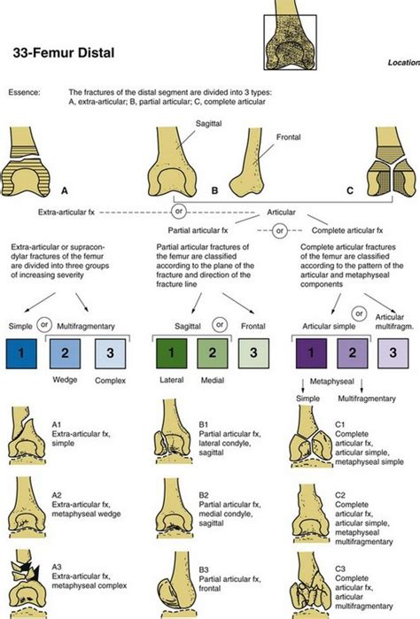 Distal Femur Fractures | Musculoskeletal Key