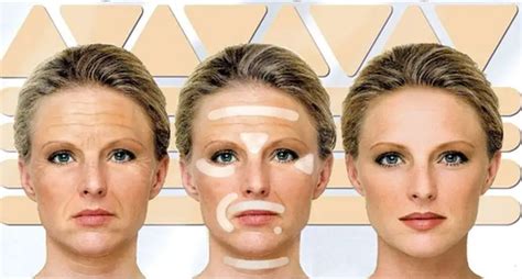 Best Botox Alternative 2024