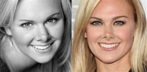 Laura Bell Bundy Nose Job Before And After Pictures