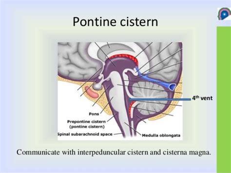 Basal Cisterns Anatomy