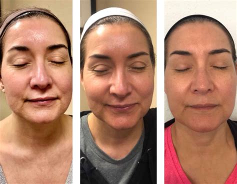 Regenerative - Brynna Connor MD