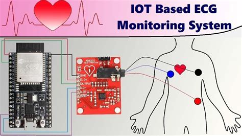 Iot Based Ecg Monitoring With Ad8232 Ecg Sensor And Esp32 | Images and Photos finder