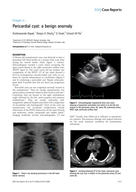 (PDF) Pericardial cyst: A benign anomaly