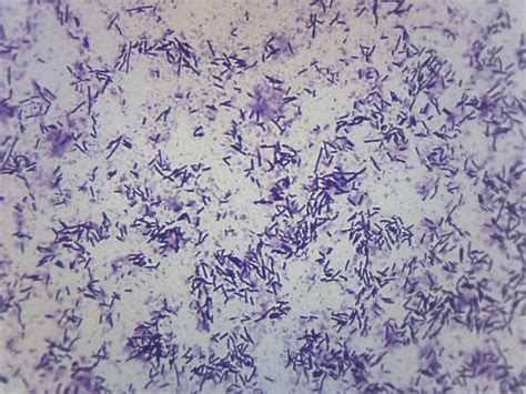 Eisco Prepared Microscope Slide - Escherichia Coli Smear, Gram Stain ...