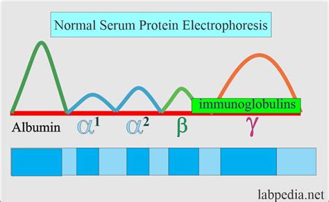 Serum Protein Electrophoresis, Total protein, albumin and globulin - Labpedia.net