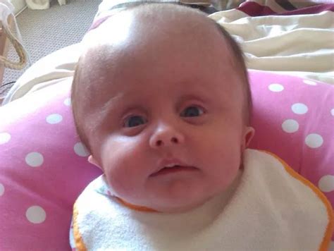 Baby born with adult-sized head defies doctors by surviving 40 operations - and is still smiling ...