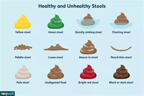 What Do the Different Poop Colors and Shapes Mean? | Healthy poop, Color, Stool color chart