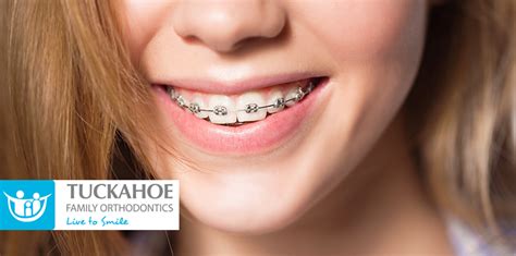 How Long Does Orthodontic Treatment Typically Last?