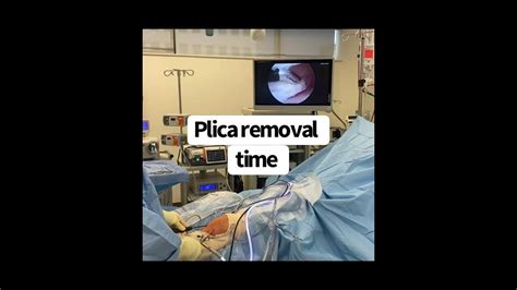 Anterior Knee Pain PLICA Surgery #MoraMD #theUFCfighterSurgeon - YouTube