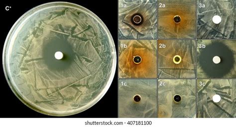 Antibiogram Images, Stock Photos & Vectors | Shutterstock