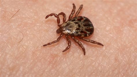 Wisconsin deer ticks: Watch for Lyme, Anaplasmosis, other diseases