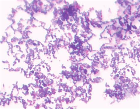 Gram-stained S. mutans | Download Scientific Diagram