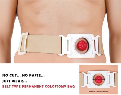 Aggregate 80+ colostomy bag online india super hot - in.duhocakina