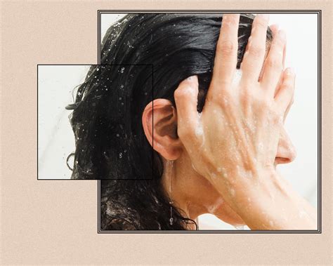 Shampoos For Scalp Psoriasis: A Complete Guide