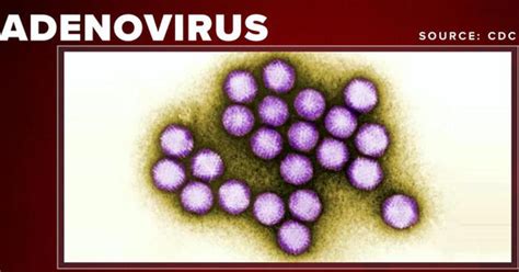 At least 12 dead amid adenovirus outbreak - CBS News