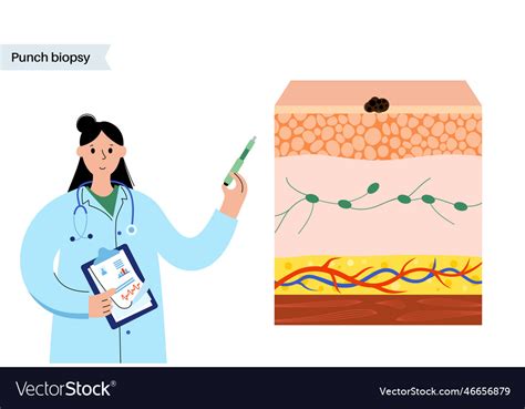 Punch biopsy procedure Royalty Free Vector Image