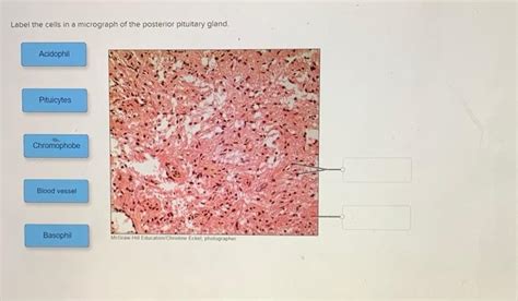 Solved Label the cells in a micrograph of the posterior | Chegg.com