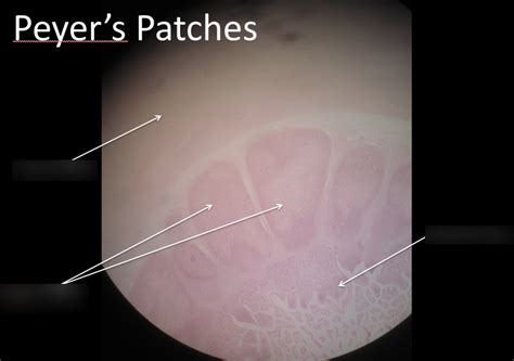 Peyer's Patches Histology Diagram | Quizlet