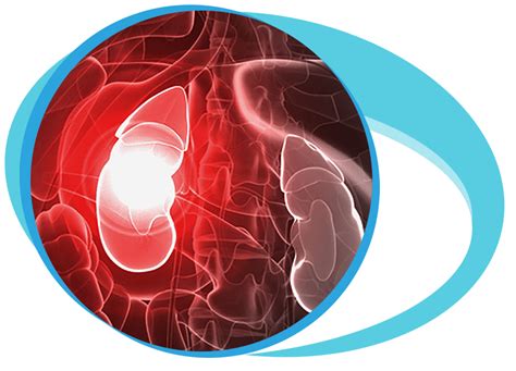 Radical Nephrectomy In Iran | Medpersia Medical Tourism