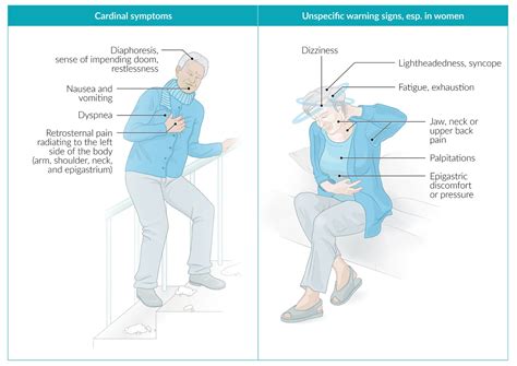 Cardiac Ischemia Symptoms Women