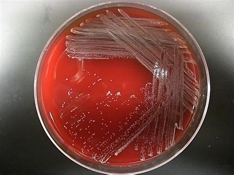 Diphtheria Corynebacterium (Corynebacterium diphtheriae) - the ...