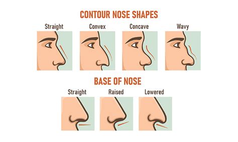 Different Nose Types