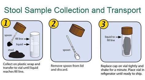 Collection and transport of stool specimens