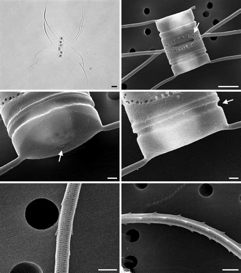 Chaetoceros diversus (A, light microscope; B-F, scanning electron... | Download Scientific Diagram