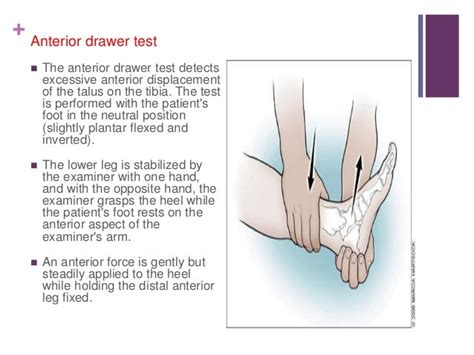 nursing bibs: Anterior drawer test