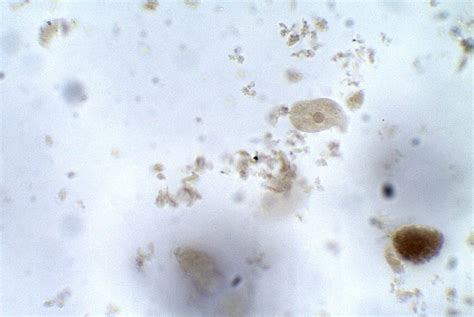 Entamoeba coli – Trophozoite – Parasitology