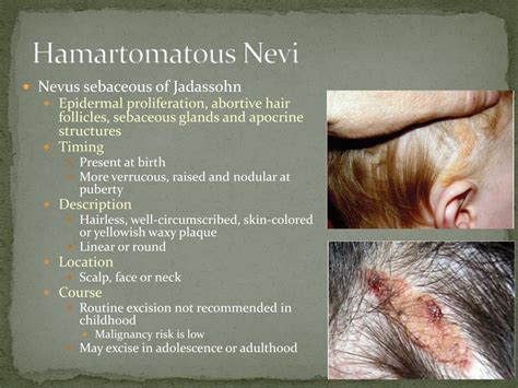 PPT - Hemangiomas and Vascular Malformations PowerPoint Presentation ...