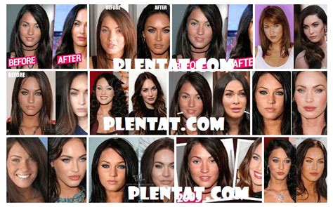 Megan Fox Plastic Surgery Before And After American Actress And Model