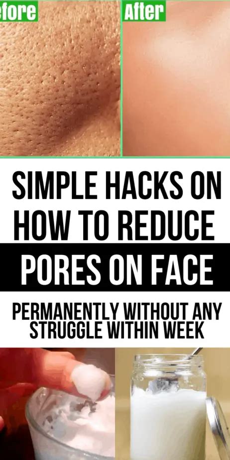 Simple Hacks On How To Reduce Pores On Face Permanently Without Any ...