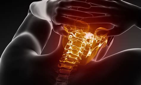 Broken Neck: X-Ray Diagnosis and Treatment