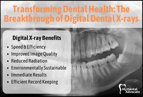 The Breakthrough of Digital Dental X-rays | MDA