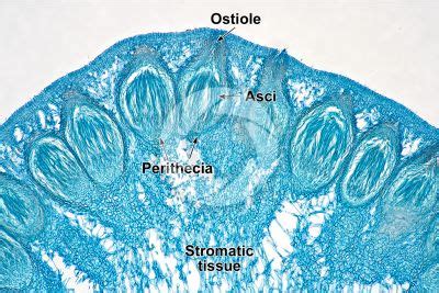 Claviceps purpurea - Ascomycota - Fungi - Plant histology - Photos