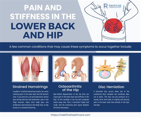 Why Does My Lower Back and Hip Hurt? - NJ's Top Orthopedic Spine & Pain Management Center