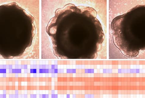 Sequencing trick identifies brain cells affected by large autism-linked mutation | Spectrum ...