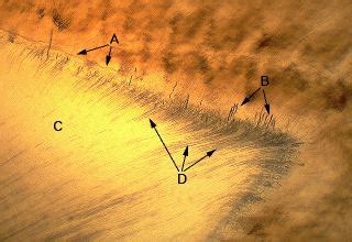 Oral Histology Digital Lab: Dentin: Enamel Spindles (Image 7)