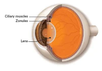 Zonules - American Academy of Ophthalmology