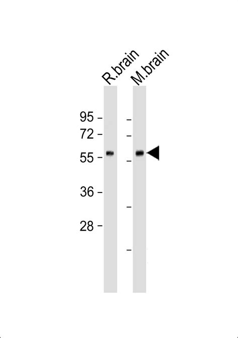 GAD2 Antibody - Mouse Monoclonal Antibody (Mab) WB, E - Buy Now! |Abcepta