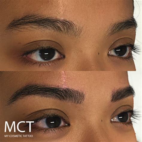 Eyebrows scar camouflage – My Cosmetic Tattoo