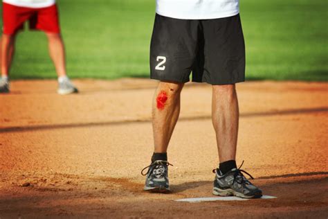 Preventing and Treating Baseball Injuries for Spring and Summer - In ...