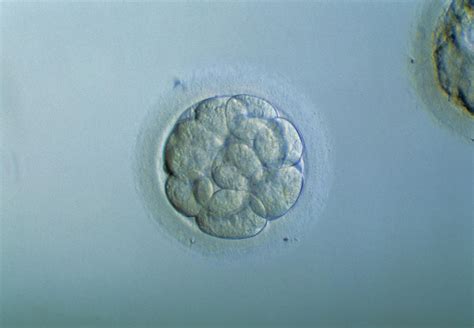 Morula Embryo Photograph by Pascal Goetgheluck/science Photo Library - Pixels