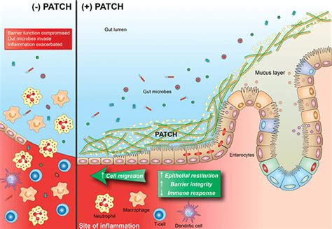 Empowering mucosal healing… | Harvard Office of Technology Development