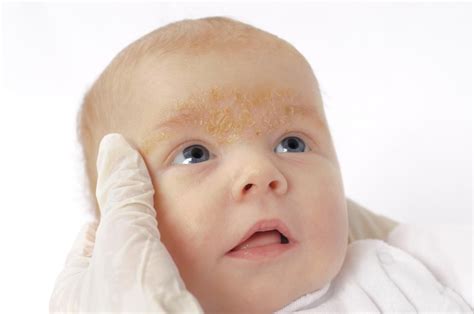 Rash on a baby's face: Pictures, causes, and treatments