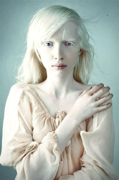 Nastya Kumarova for VOGUE | Albinism, Albino model, Portrait